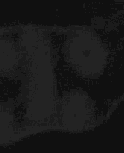 CBCT showing complex anatomy and  palatal location of the MB2 canal by Cincinnati endodontist Dr. Sullivan of Mason Endodontics and Microsurgery