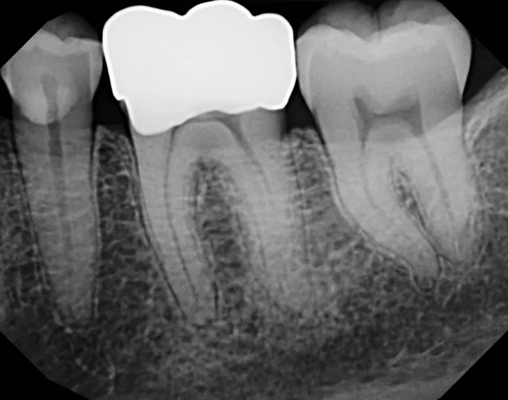 #19 Endo Pre-Op